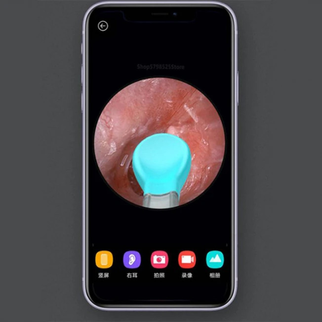 گوش پاک کن هوشمند شیائومی مدل M9 Pro ۶